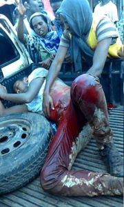 #OromoProtests, Awaday, Oromia  31 July 2016.  Fascist Ethiopia's regime forces killed 6 people and injured 26.